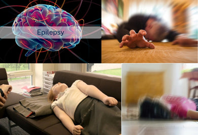 Caring for Individuals with Epilepsy