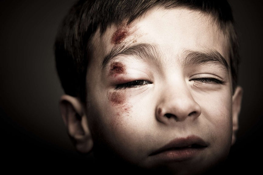 Protecting & Supporting Children Affected by Abuse & Neglect