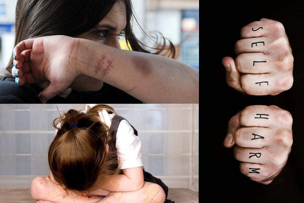 Self-Harm Prevention for Clients with Disabilities